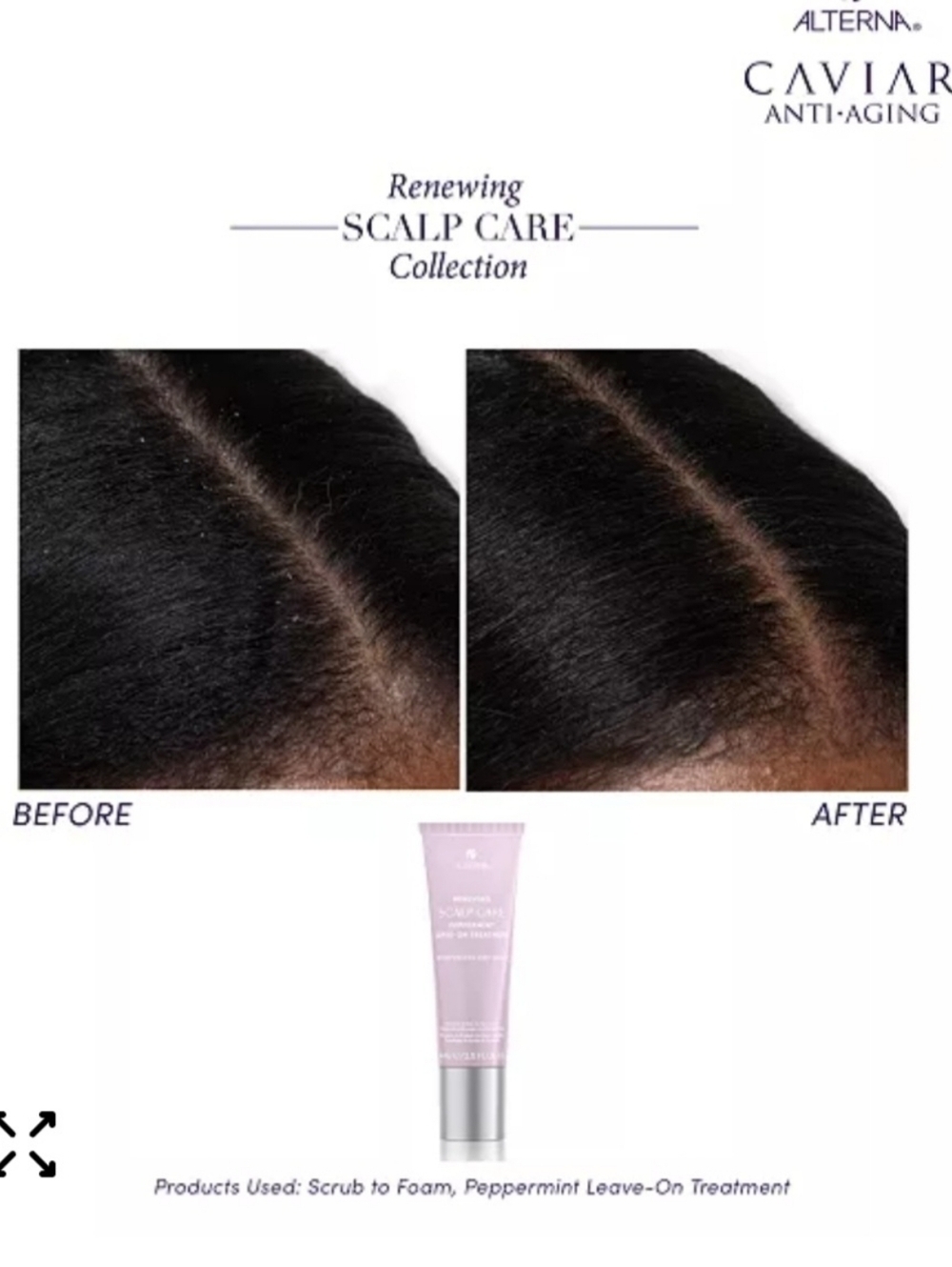 Alterna Renewing Scalp Care Peppermint Leave-On Treatment - Picture 6 of 15